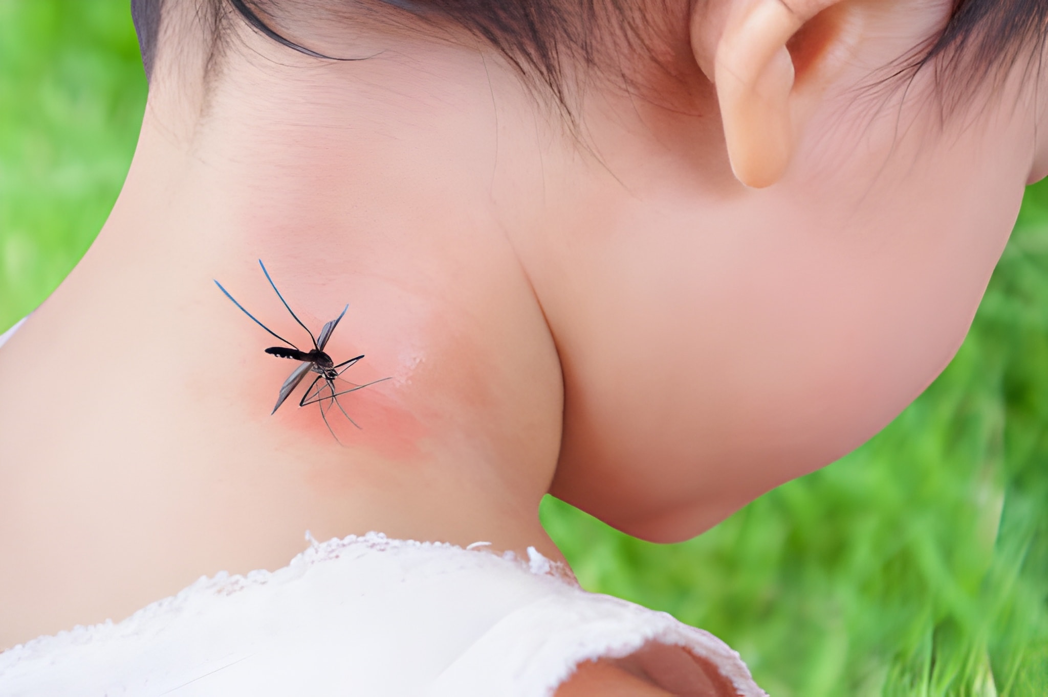 A close-up of a large mosquito landing on and biting a person's neck, with a red, inflamed welt visible on the skin. This image highlights the need for effective martin county mosquito control.